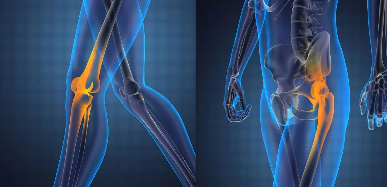 Knee & Hip Replacement in India